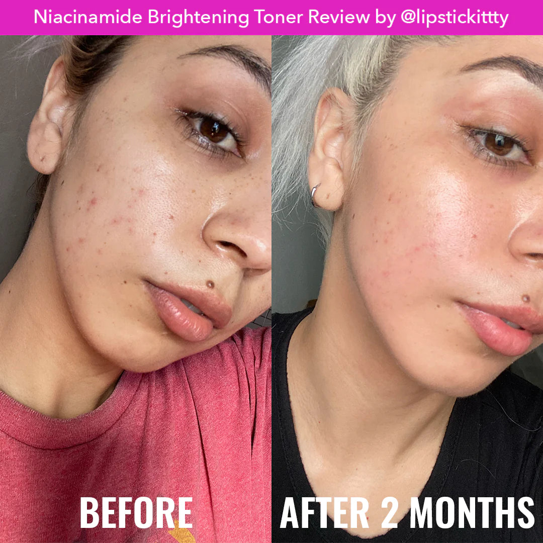 Good Molecules Niacinamide Brightening Toner