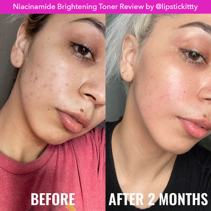 Good Molecules Niacinamide Brightening Toner